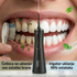 Milly irigator za zube | 1+1 GRATIS